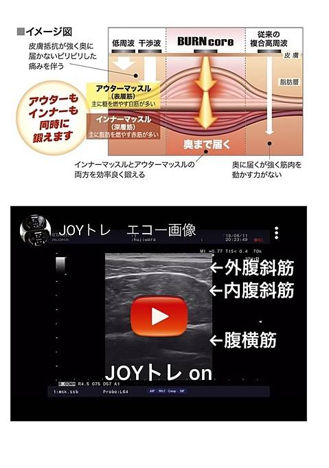高周波EMS「JOYトレ」って？ | 青森:接骨院 整骨院 古川接骨院
